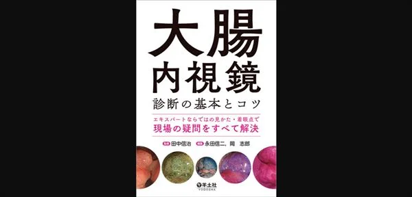 安住紳一郎 大腸内視鏡検査の無限トイレ地獄を語る | miyearnZZ Labo